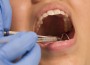 Dental+exam+-+woman's+mouth_8ef398b4-5e2f-4c4f-9fb3-5cf763517280-prv